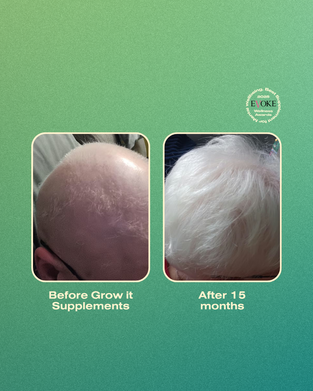 Grow it Haircare Supplement - 1 Month