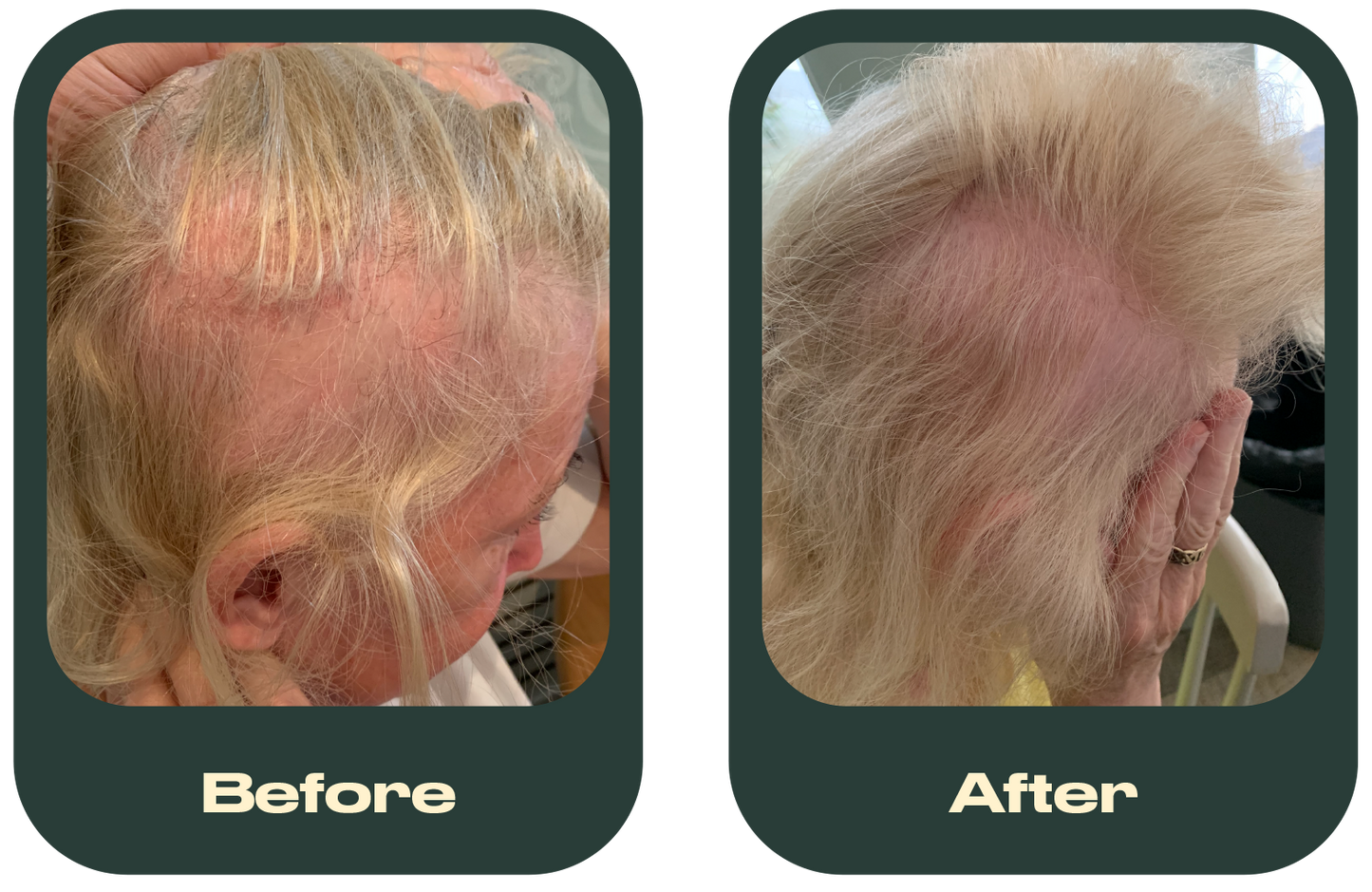 Grow It Hair Supplement - 1 Month