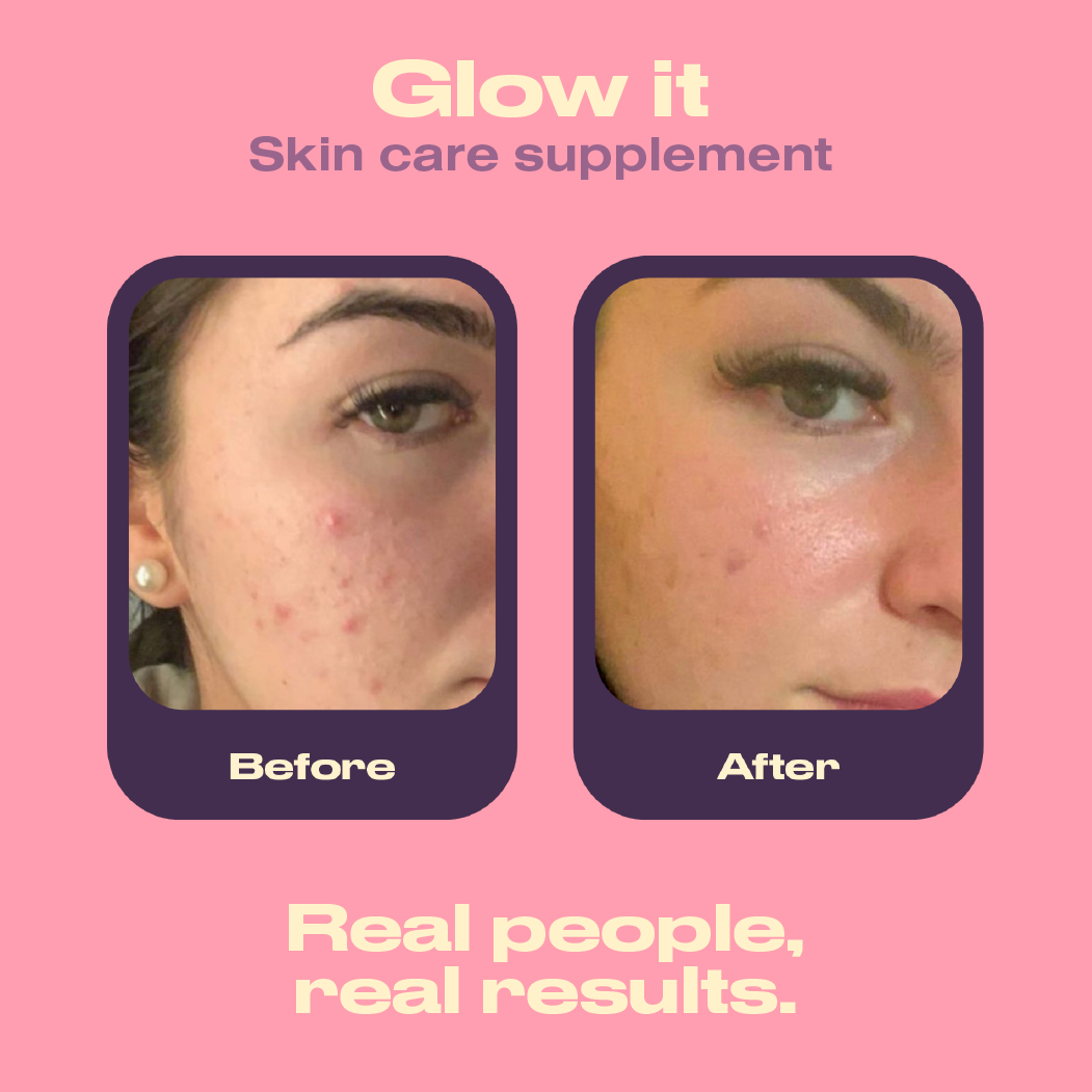 Before and after comparison of a skin care supplement on a pink background with text 'Glow it Skin care supplement'.
