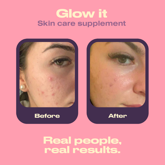 Before and after comparison of a skin care supplement on a pink background with text 'Glow it Skin care supplement'.