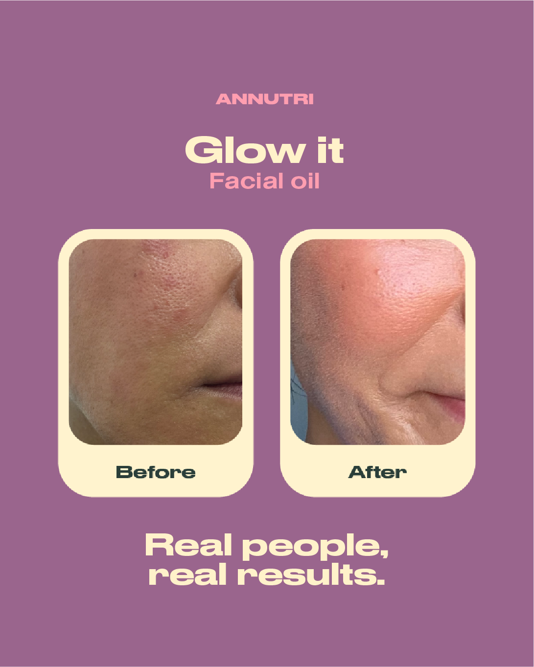 Glow it Facial oil 30ml