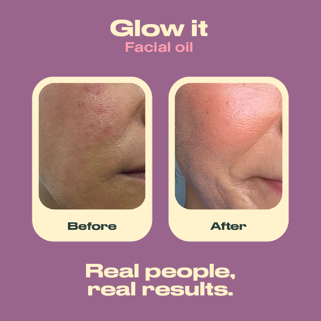 Before and after comparison of facial skin with 'Glow it Facial Oil' on a purple background.