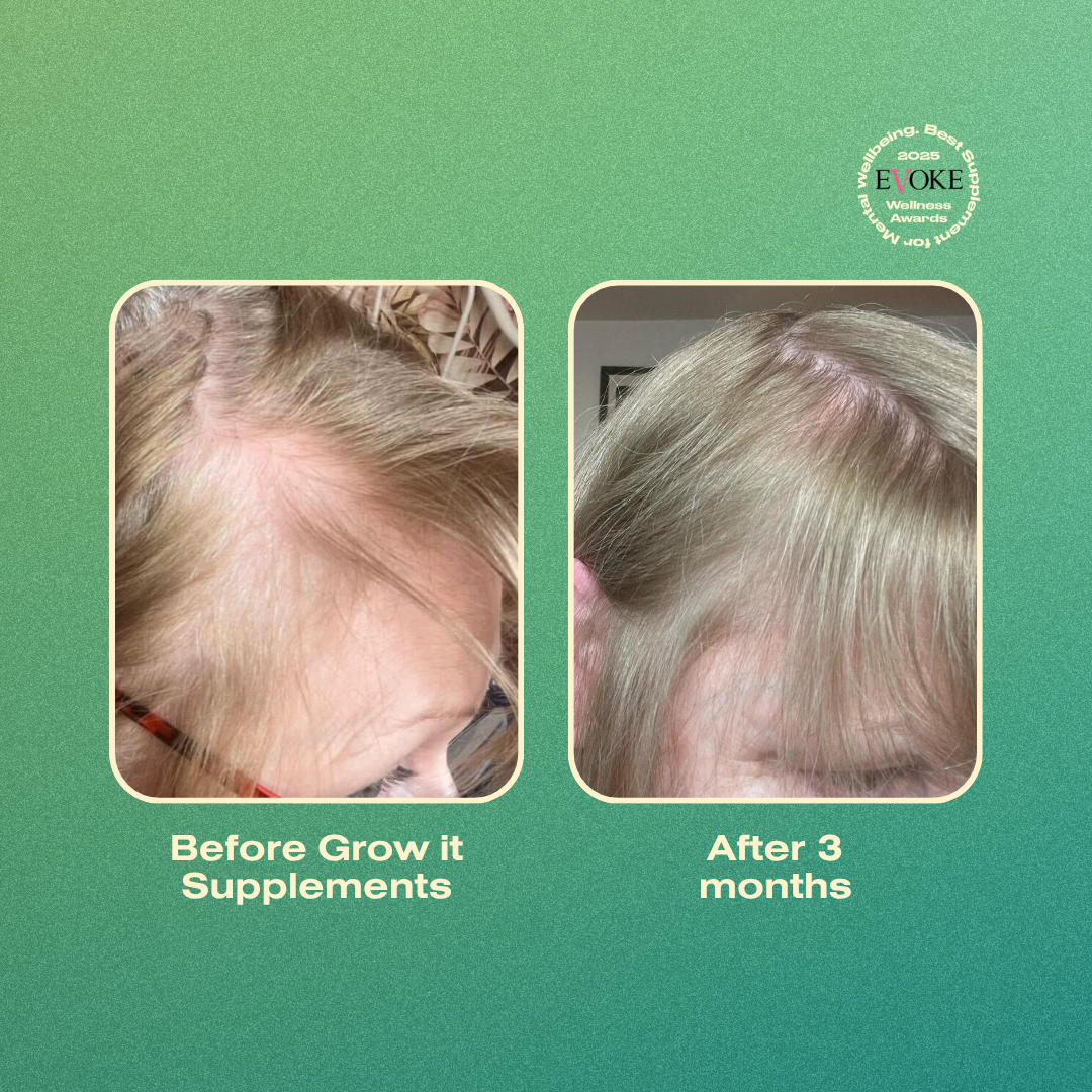 Before and after hair growth comparison with 'Grow it Supplements' on a green background