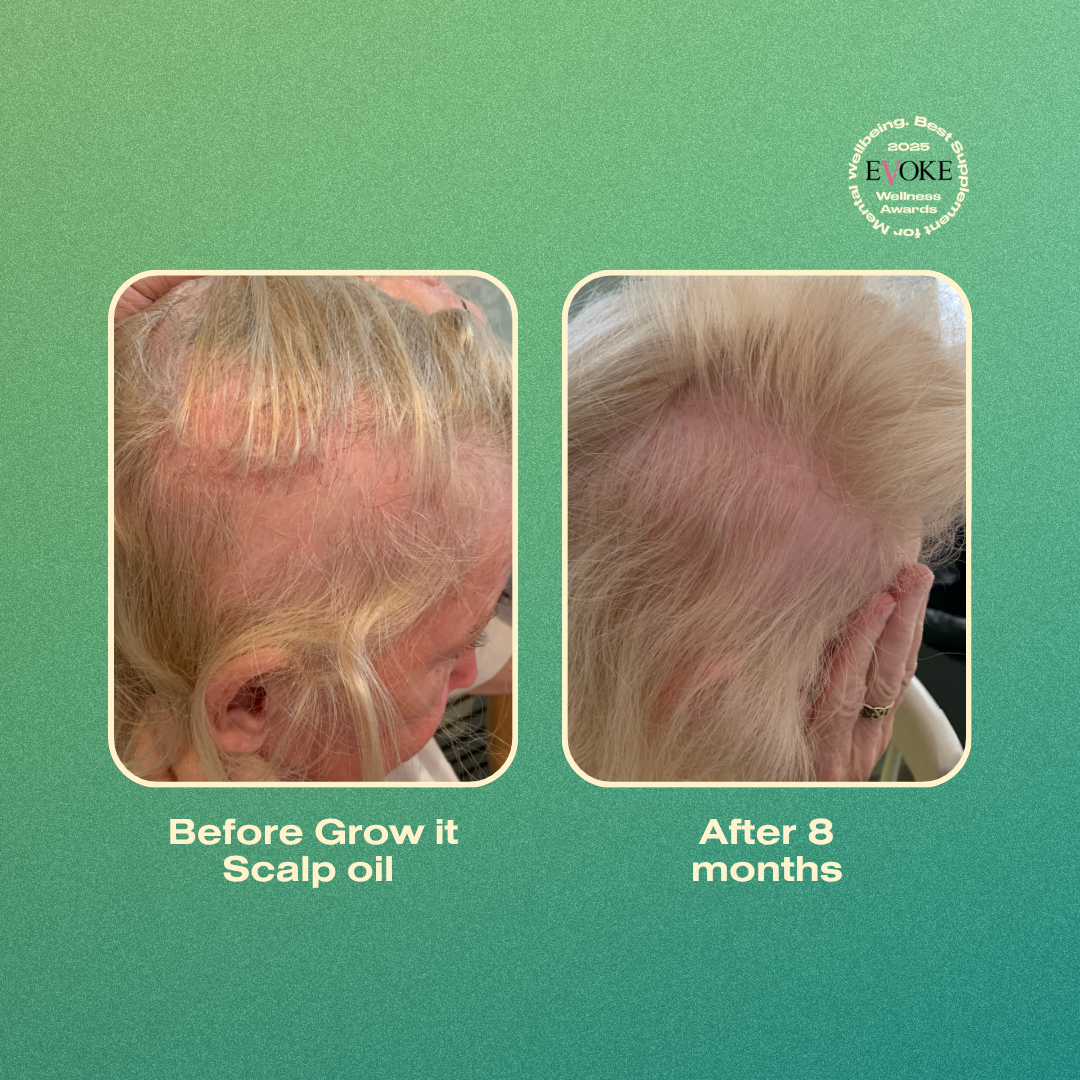 Before and after comparison of scalp treatment with 'Annutri Grow it Scalp Oil' on a green background.