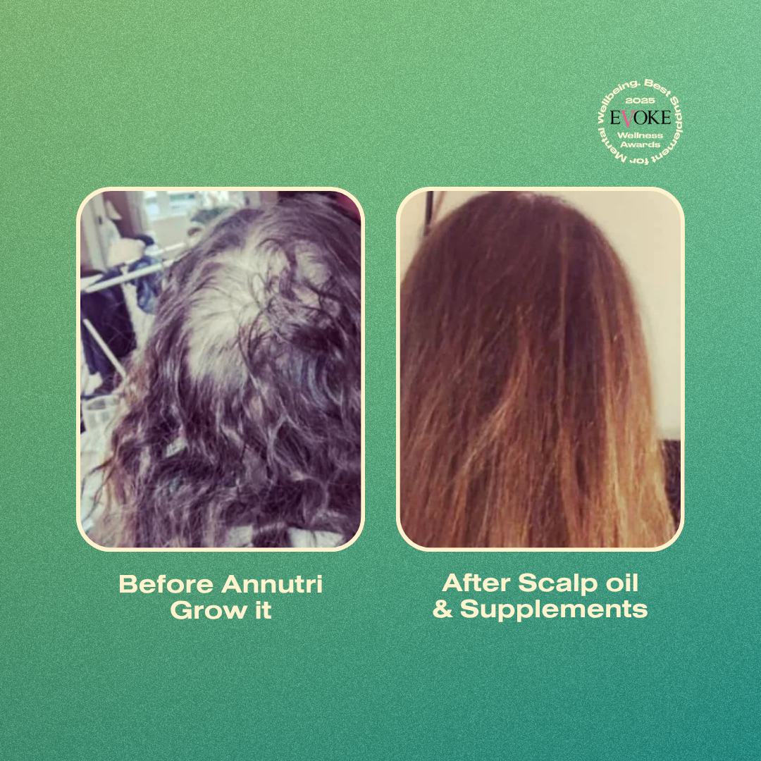 Amazing before and after comparison of hair growth with Annutri Grow it scalp oil and supplements on a green background.