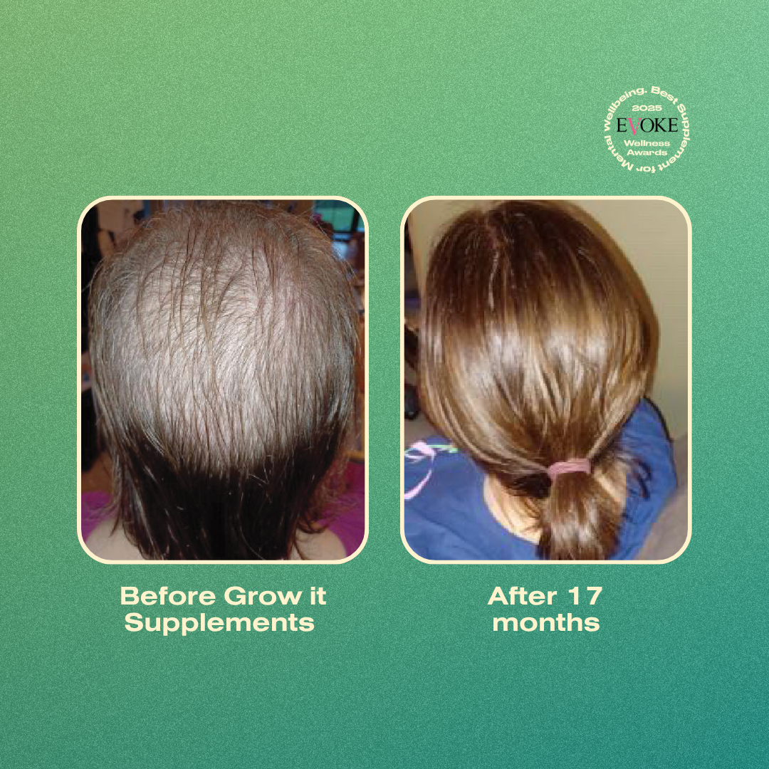 Before and after comparison of hair growth with 'Grow it Supplements' on a green background.