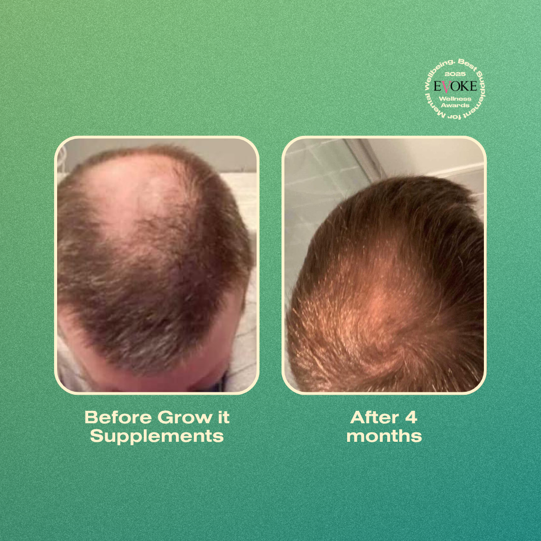 Before and after hair growth supplement comparison on a green background