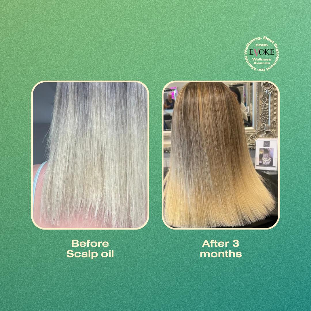 Before and after comparison of hair treatment with Annutri Grow it Scalp oil on a green background
