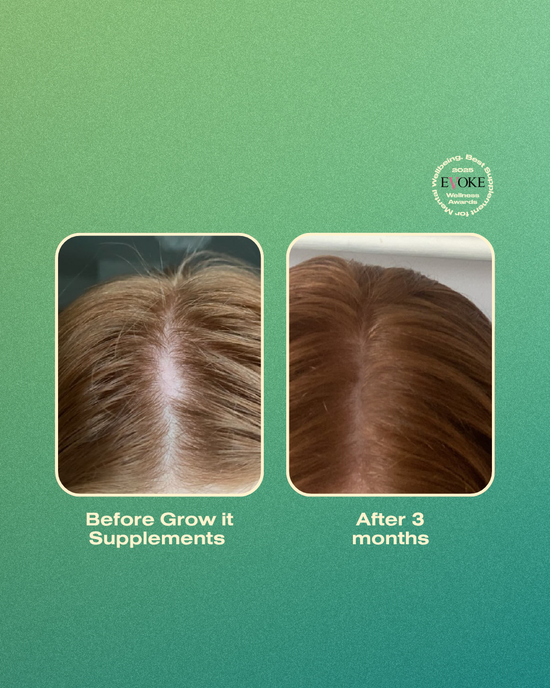 Before and after comparison of hair growth with 'Evoke' supplement on a green background