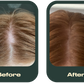 Grow it Ultimate hair bundle  - 3 Months Hair supplements + Scalp oil + FREE €11 Microfibre hair towel